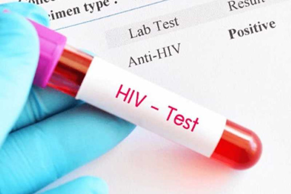 730 new HIV infections recorded in Volta Region last year