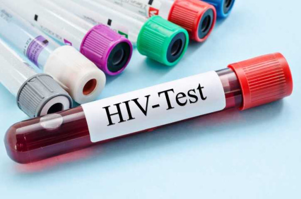 Health officials worry about continued increase in HIV infections in Ashanti region 