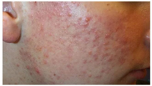 All About Common Skin Disorders