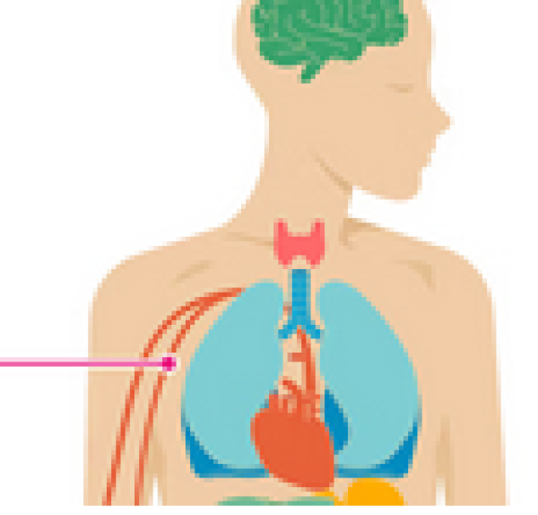 How High Cholesterol Affects Your Body