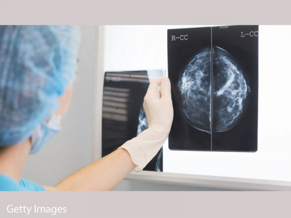 AI 'outperforms' doctors diagnosing breast cancer