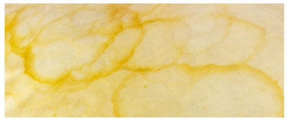 Fixing Yellow Oily Drops on Walls