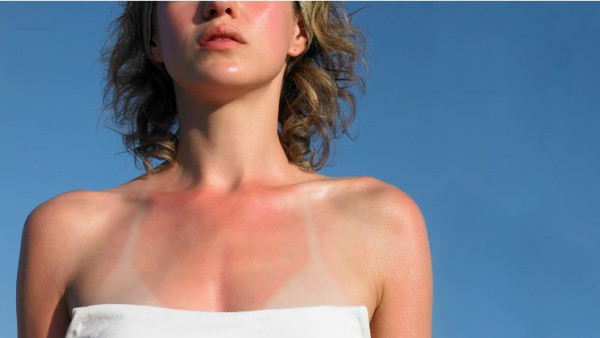 7 Body Parts People Always Miss with Sunscreen