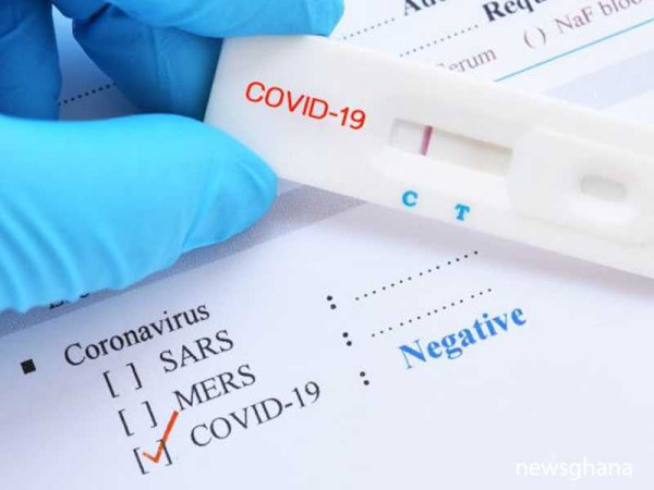Country-specific measures on global COVID-19 situation to be released