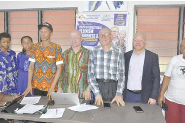 International Albinism Awareness Day marked in Ho