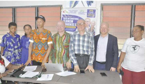 International Albinism Awareness Day marked in Ho
