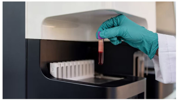 Can Blood Tests Be Used to Diagnose EPI?