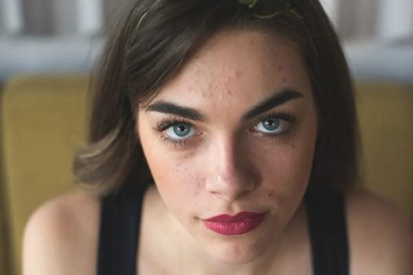 7 Causes of Oily Skin