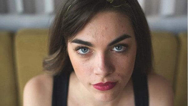 7 Causes of Oily Skin