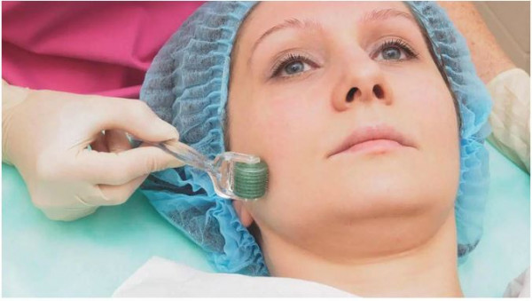 Microneedling: The Latest Craze in Skin Care