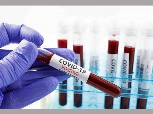 COVID-19: Ghana records over 1,000 new cases for fifth consecutive day