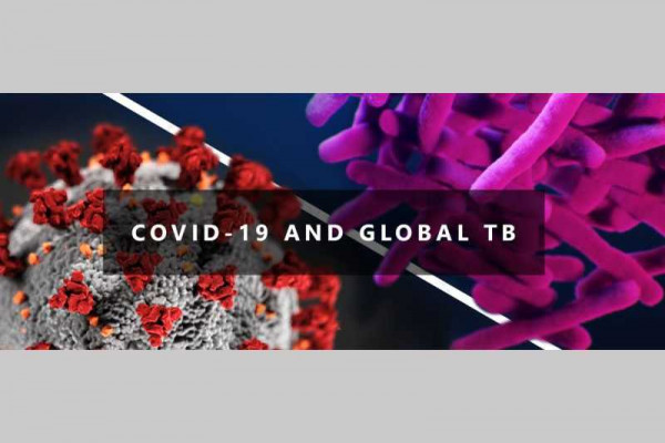 Covid-19 causing increase in undiagnosed TB cases