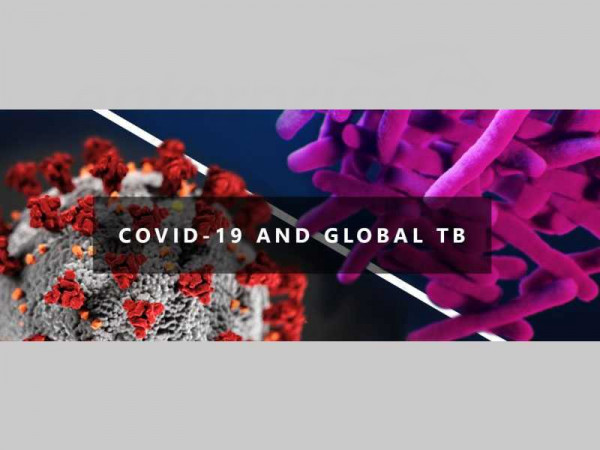 Covid-19 causing increase in undiagnosed TB cases